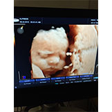 HD Ultrasound